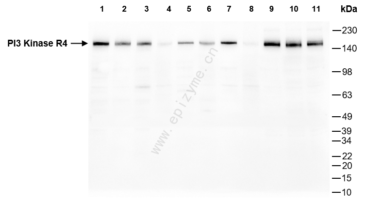 Anti-VPS15 Rabbit mAb [91D98P84]