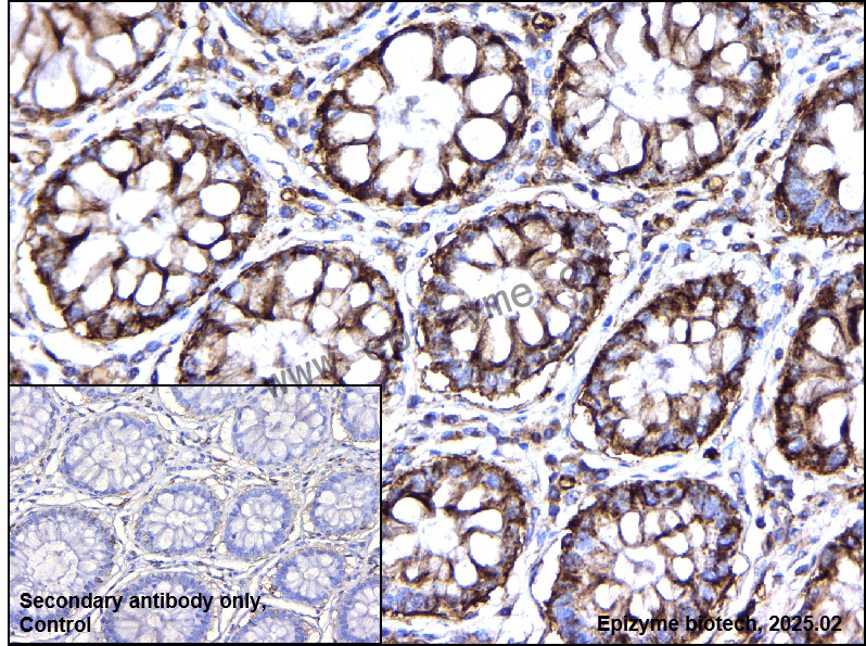 Anti-VPS15 Rabbit mAb [91D98P84]