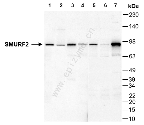 Anti-SMURF2 Rabbit mAb [82K41B79]