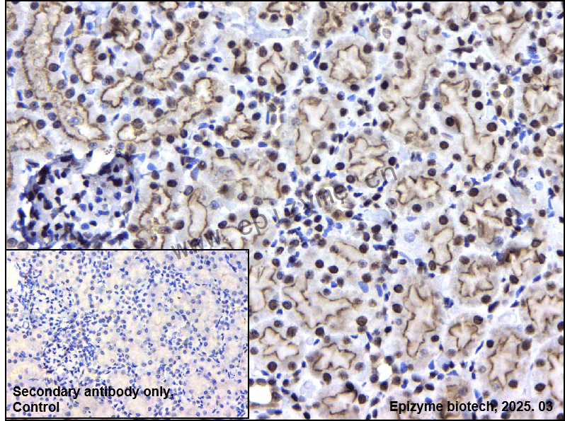 Anti-ILF3 Rabbit mAb [23D20H07]