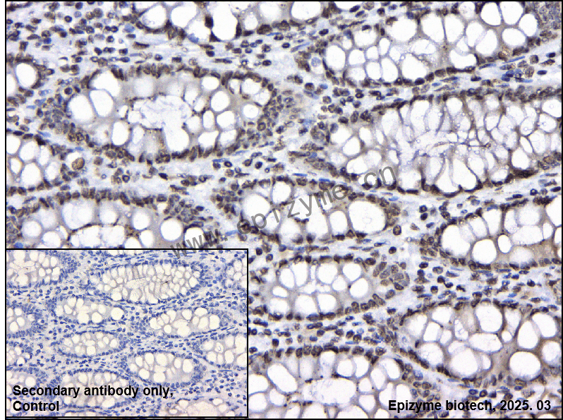 Anti-ILF3 Rabbit mAb [23D20H07]