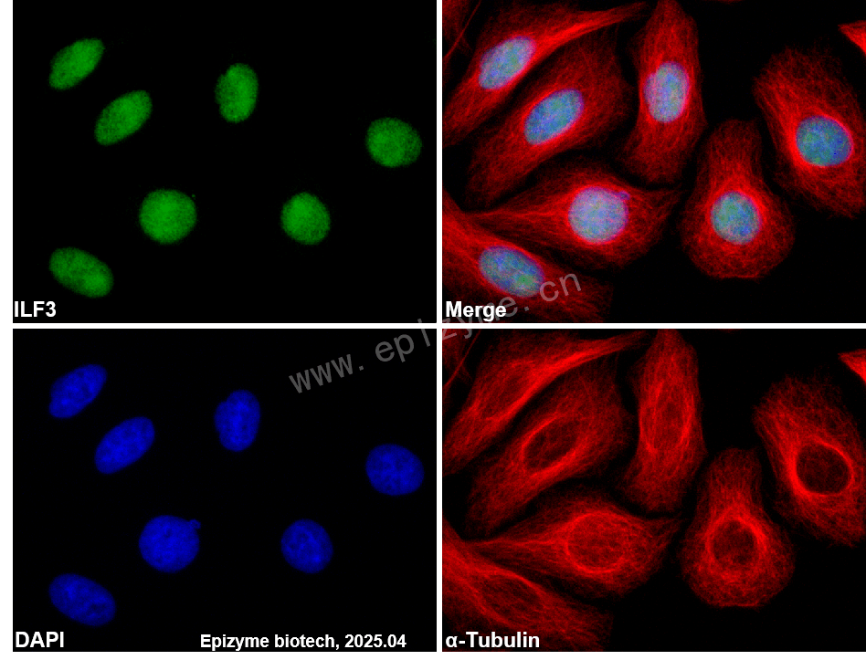 Anti-ILF3 Rabbit mAb [23D20H07]