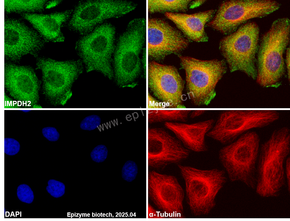 Anti-IMPDH2 Rabbit mAb [92B47K82]