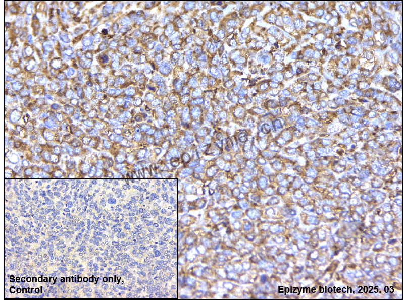 Anti-IMPDH2 Rabbit mAb [92B47K82]