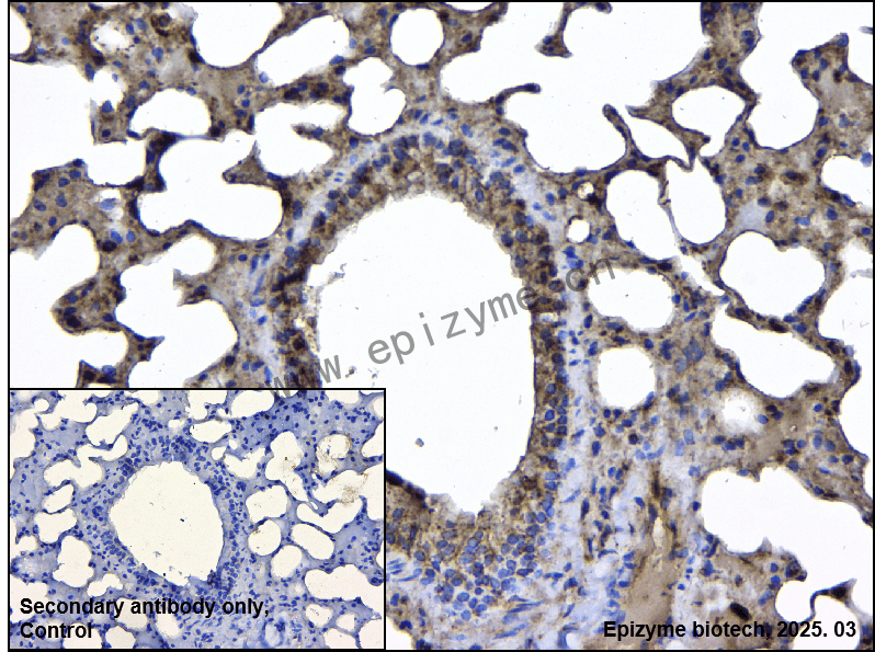 Anti-IMPDH2 Rabbit mAb [92B47K82]