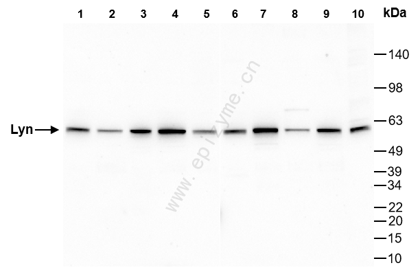 Anti-Lyn Rabbit mAb [54J29I60]