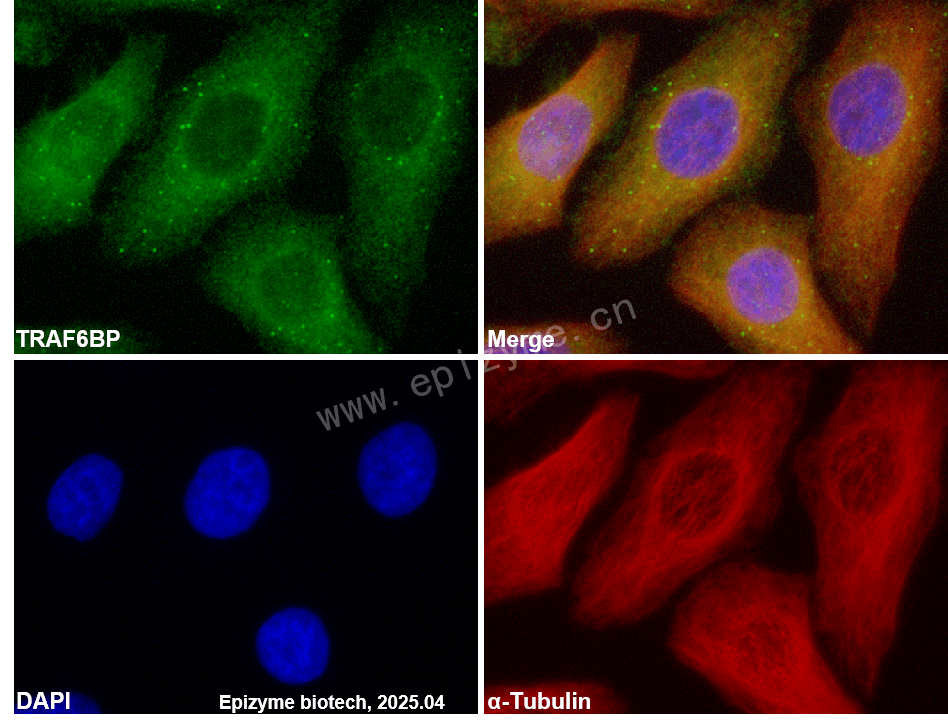 Anti-TRAF6BP/TAX1BP1 Rabbit mAb [91T40G35]