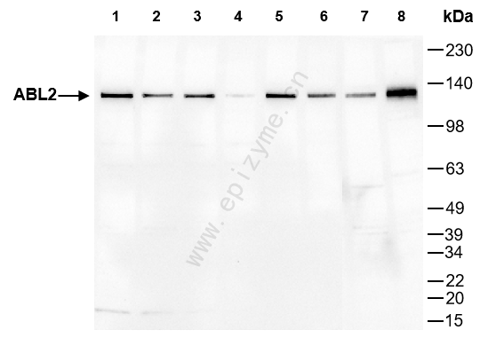 Anti-ABL2 Rabbit mAb [65K48M09]