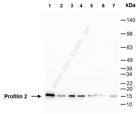 Anti-Profilin 2 Rabbit mAb [84U02P79]