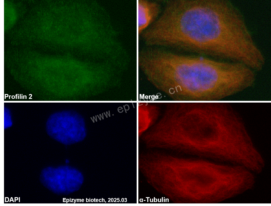 Anti-Profilin 2 Rabbit mAb [84U02P79]