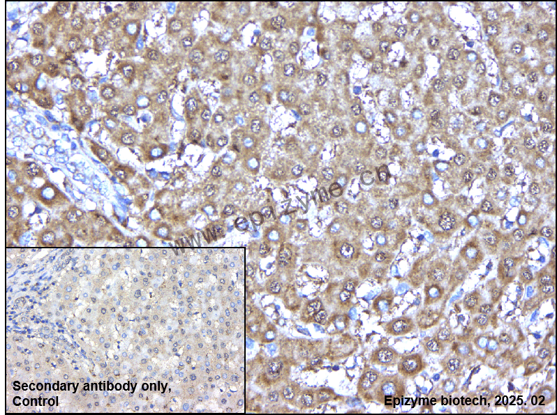 Anti-Fas/CD95 Rabbit mAb [21K58A42]
