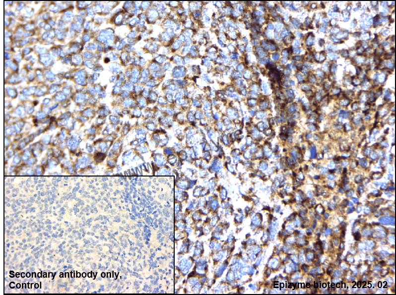 Anti-Fas/CD95 Rabbit mAb [21K58A42]