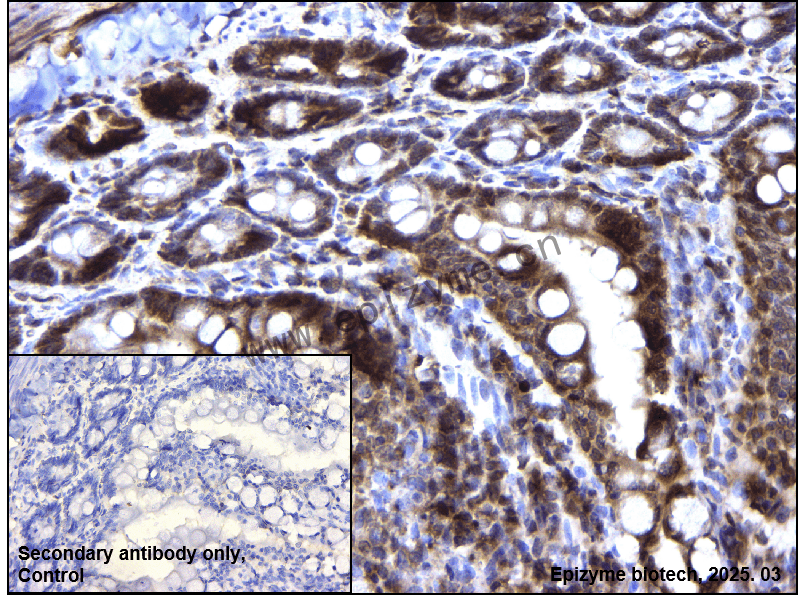 Anti-WIPI1 Rabbit mAb [84G66B56]