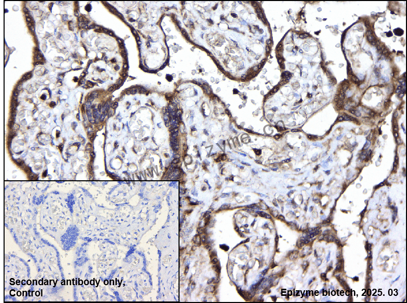 Anti-WIPI1 Rabbit mAb [84G66B56]