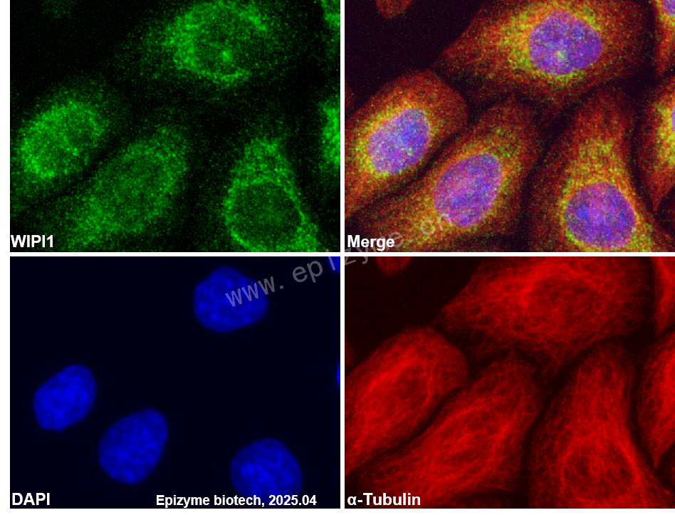 Anti-WIPI1 Rabbit mAb [84G66B56]