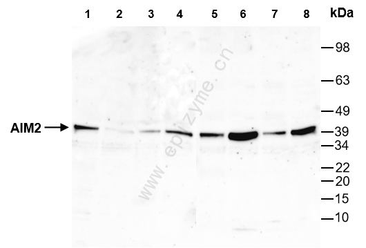 Anti-AIM2 Rabbit mAb [37A78U53]