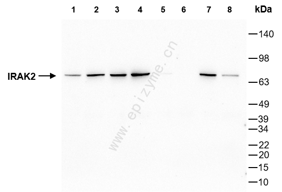 Anti-IRAK2 Rabbit mAb [21N65K35]