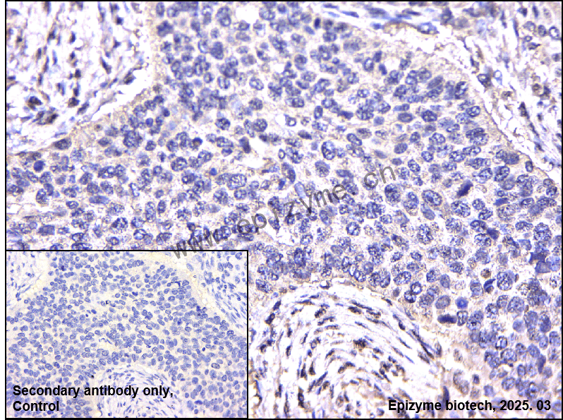 Anti-IRAK2 Rabbit mAb [21N65K35]