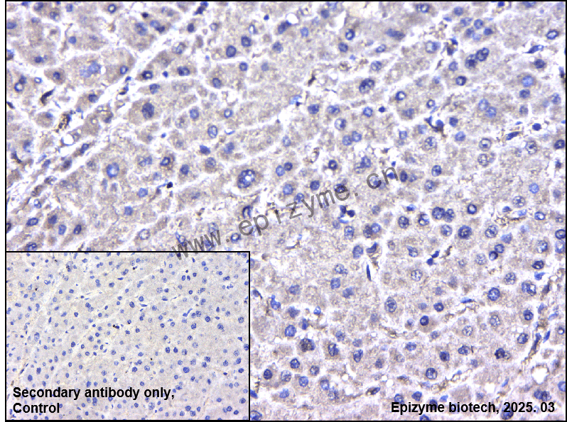 Anti-IRAK2 Rabbit mAb [21N65K35]