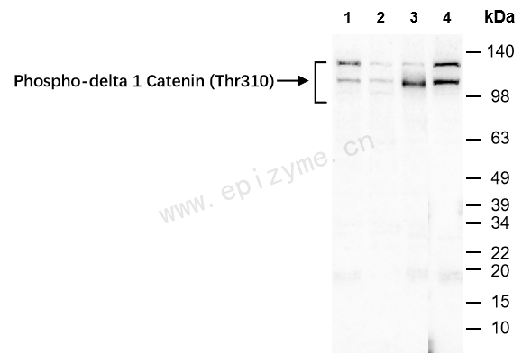Anti-Phospho-delta 1 Catenin (Thr310) Rabbit mAb [60K10Y43]