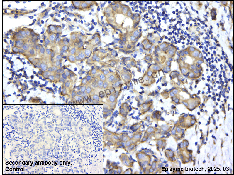 Anti-Phospho-delta 1 Catenin (Thr310) Rabbit mAb [60K10Y43]