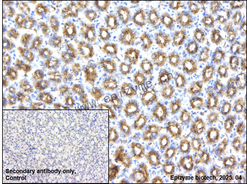 Anti-Clathrin heavy chain Rabbit mAb [59I74D57]