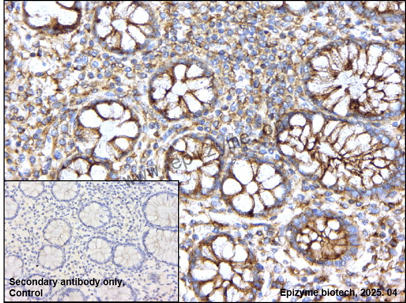 Anti-Clathrin heavy chain Rabbit mAb [59I74D57]