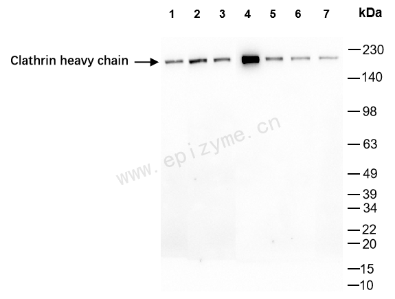 Anti-Clathrin heavy chain Rabbit mAb [59I74D57]