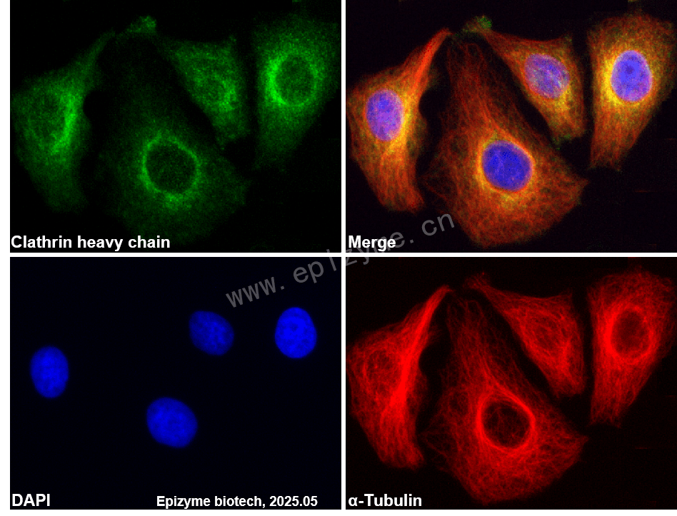 Anti-Clathrin heavy chain Rabbit mAb [59I74D57]