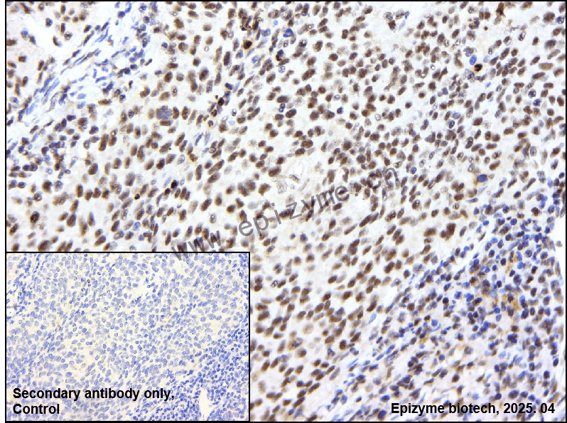 Anti-Phospho-DNA PKcs (Ser2056) Rabbit mAb [50D08H50]