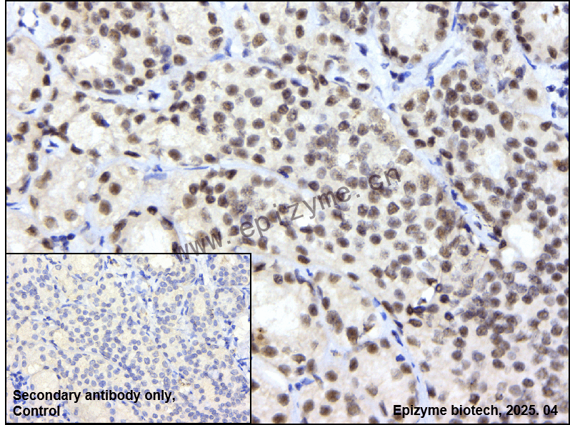 Anti-Phospho-DNA PKcs (Ser2056) Rabbit mAb [50D08H50]