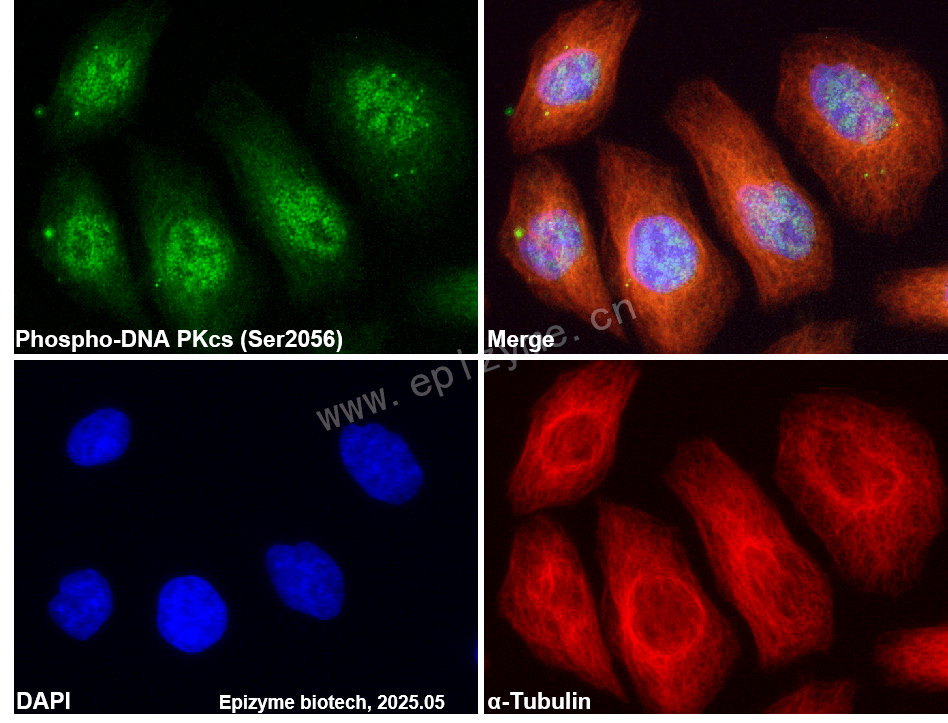Anti-Phospho-DNA PKcs (Ser2056) Rabbit mAb [50D08H50]