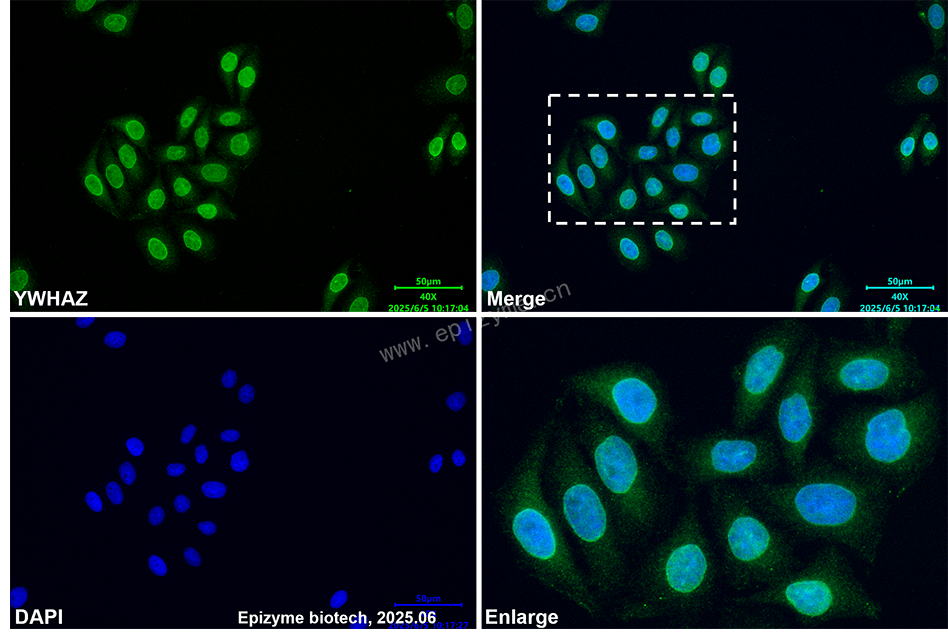 Anti-14-3-3 zeta Mouse mAb [77D48L02]