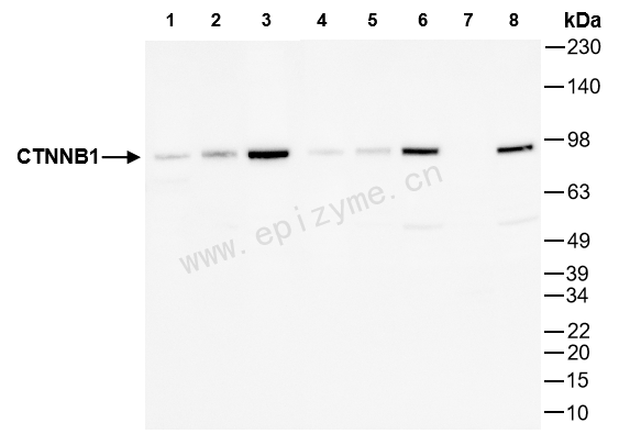 Anti-beta Catenin Mouse mAb [97L64M20]