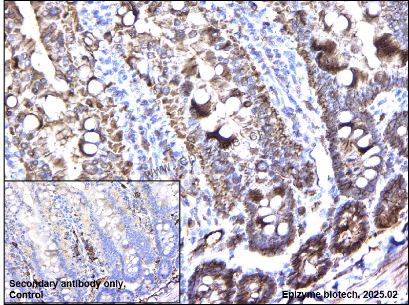Anti-beta Catenin Mouse mAb [97L64M20]