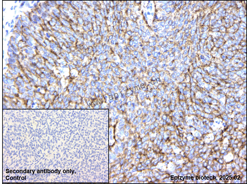Anti-beta Catenin Mouse mAb [97L64M20]
