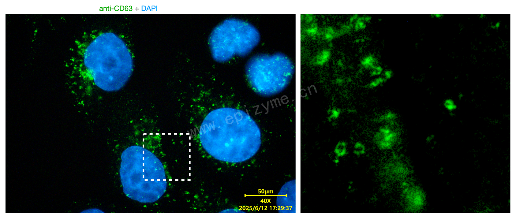 Anti-CD63 Mouse mAb [12K96F38]