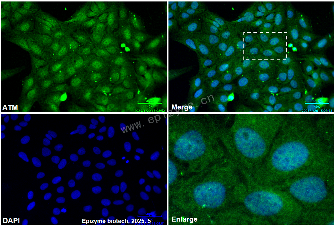 Anti-ATM Mouse mAb [33N66Q96]