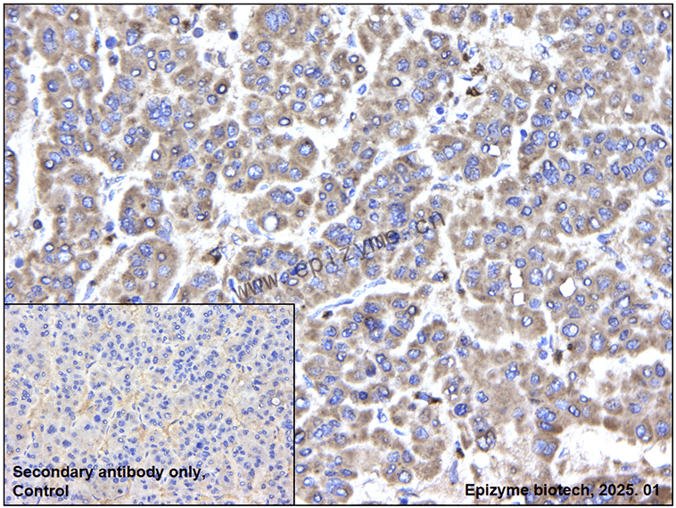 Anti-ATM Mouse mAb [33N66Q96]
