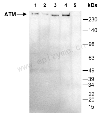 Anti-ATM Mouse mAb [33N66Q96]