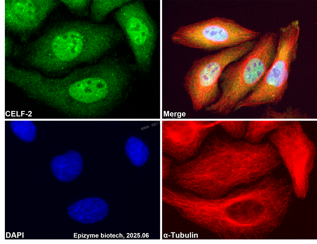 Anti-CELF2 Rabbit mAb [37M40K74]