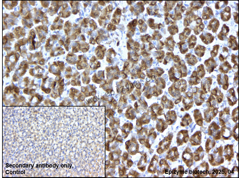 Anti-ARHGAP25 Rabbit mAb [10M49L39]