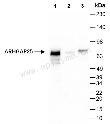 Anti-ARHGAP25 Rabbit mAb [10M49L39]