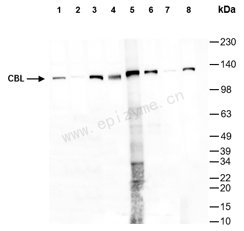 Anti-CBL Rabbit mAb [74M44K26]