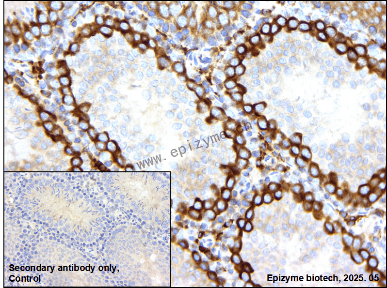 Anti-CBL Rabbit mAb [74M44K26]