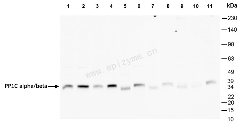 Anti-PP1C alpha/beta Rabbit mAb [66M71K40]