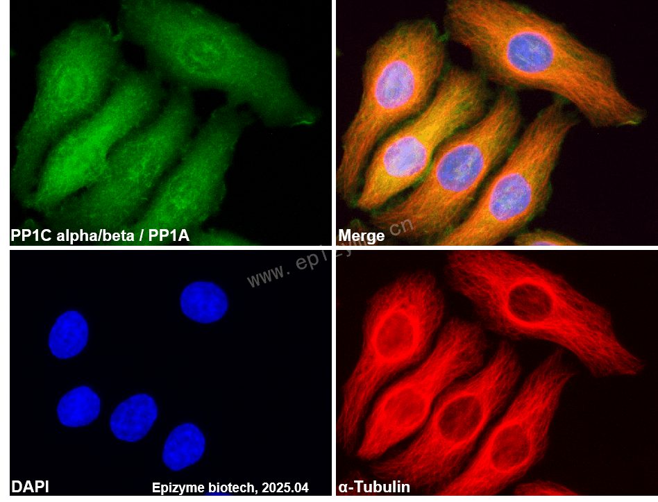 Anti-PP1C alpha/beta Rabbit mAb [66M71K40]