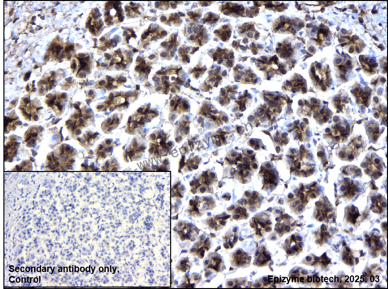 Anti-PP1C alpha/beta Rabbit mAb [66M71K40]
