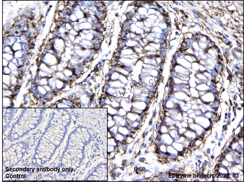 Anti-PP1C alpha/beta Rabbit mAb [66M71K40]