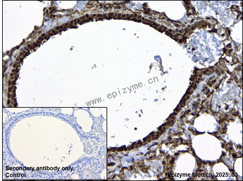 Anti-PP1C alpha/beta Rabbit mAb [66M71K40]